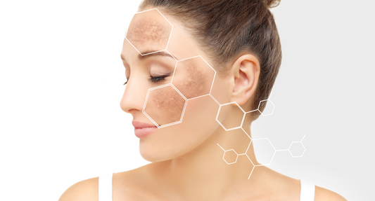 L'importance d'utiliser un peeling